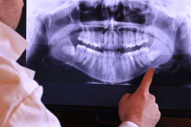 Best Emergency Broken Tooth Repair in Hartshorne, OK